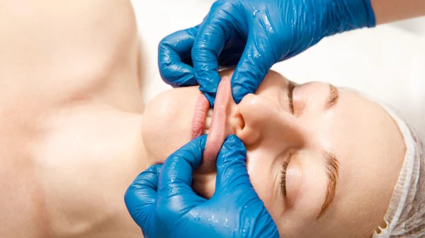Buccal behandeling